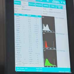 Lab view 17