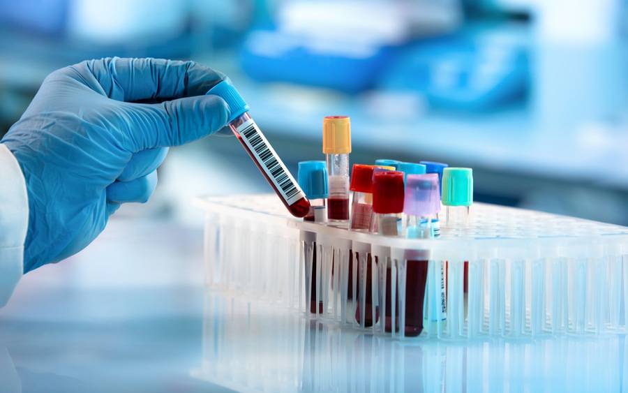 Best Blood Testing Centres Near me in Chandrapur | Justdial