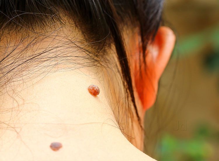 dr balasubramanian skin care clinic