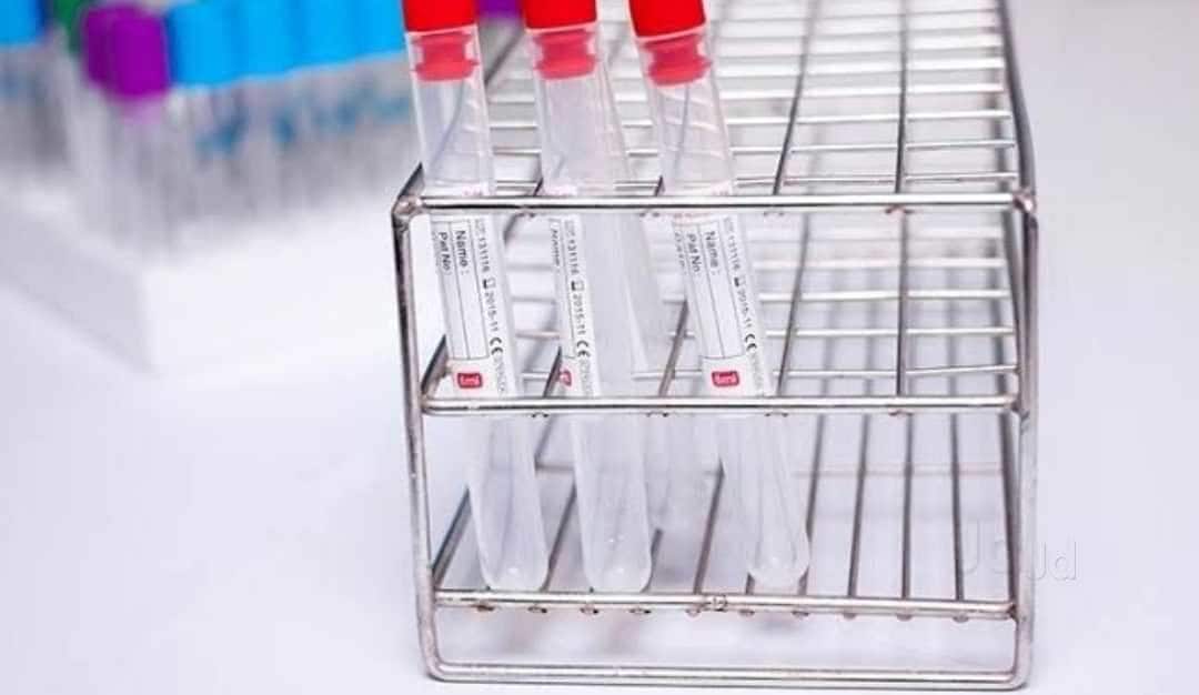 Industrial Chemical in Coimbatore High-Quality, Bulk Chemicals