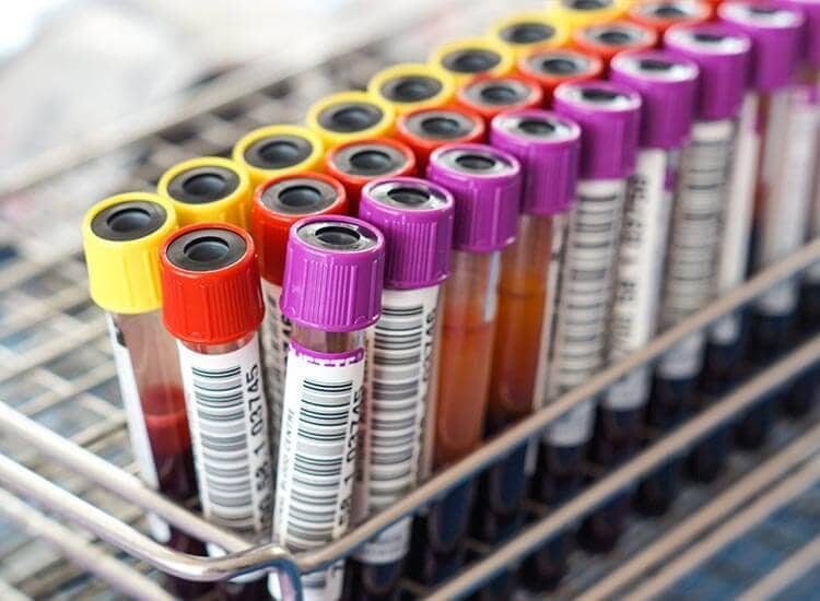 Top 10 Lab Testing For Rubbers in Bangalore लैब टेस्टिंग फॉर