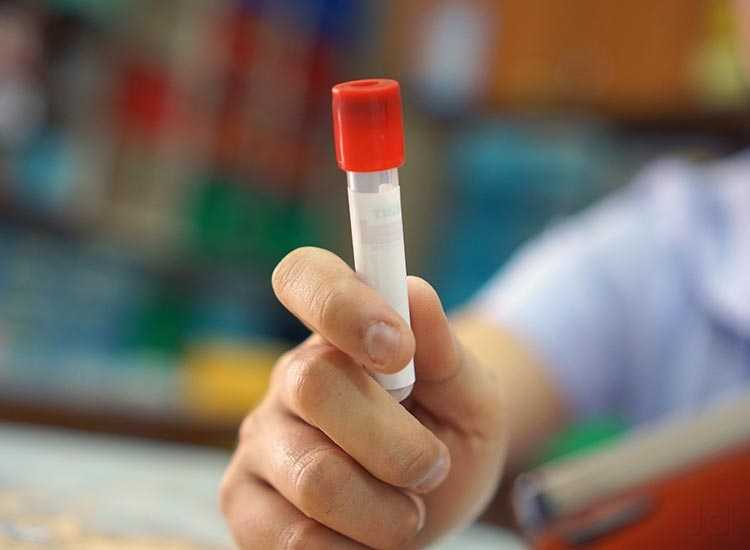 Top Blood Testing Centres in Kazhakuttam Best Laboratories For Blood