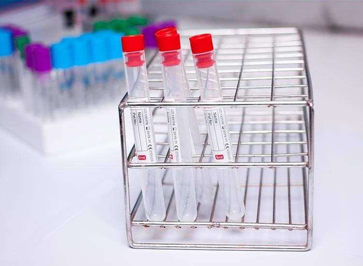 Lab view 14