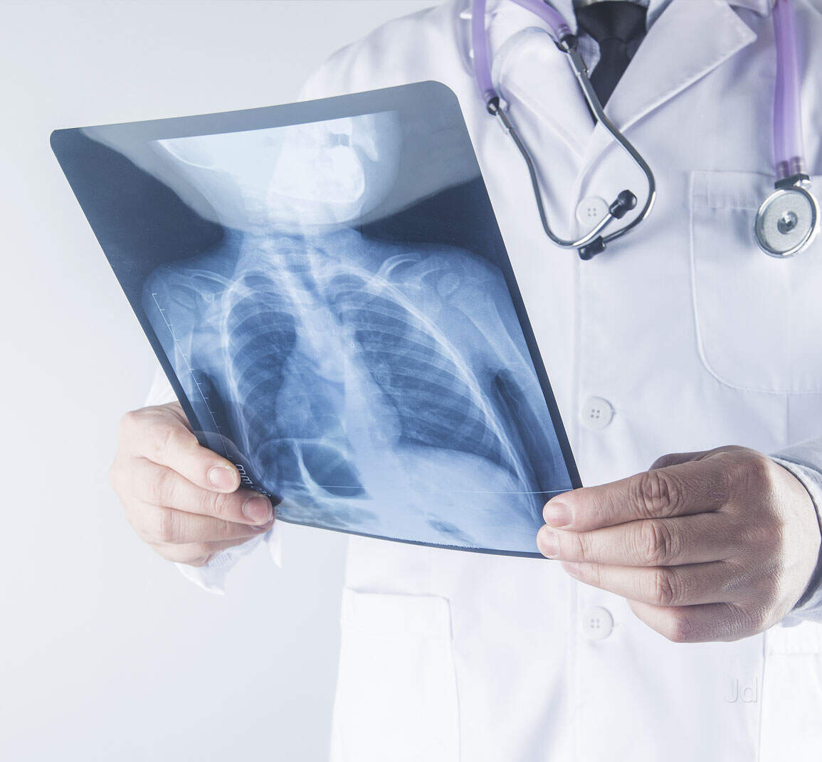 Best Bone Densitometry Testing Centres Near me in Konanakunte ...