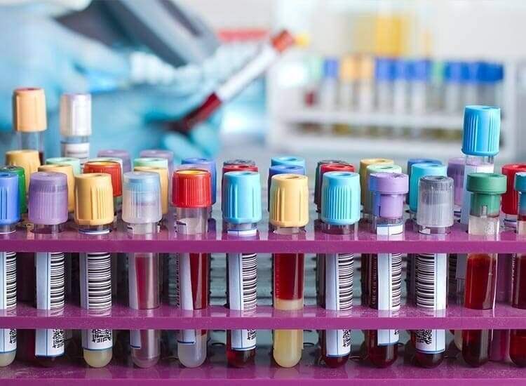 Mermo Enterprises in Lalapet, Hyderabad - Best Diagnostic Reagent ...