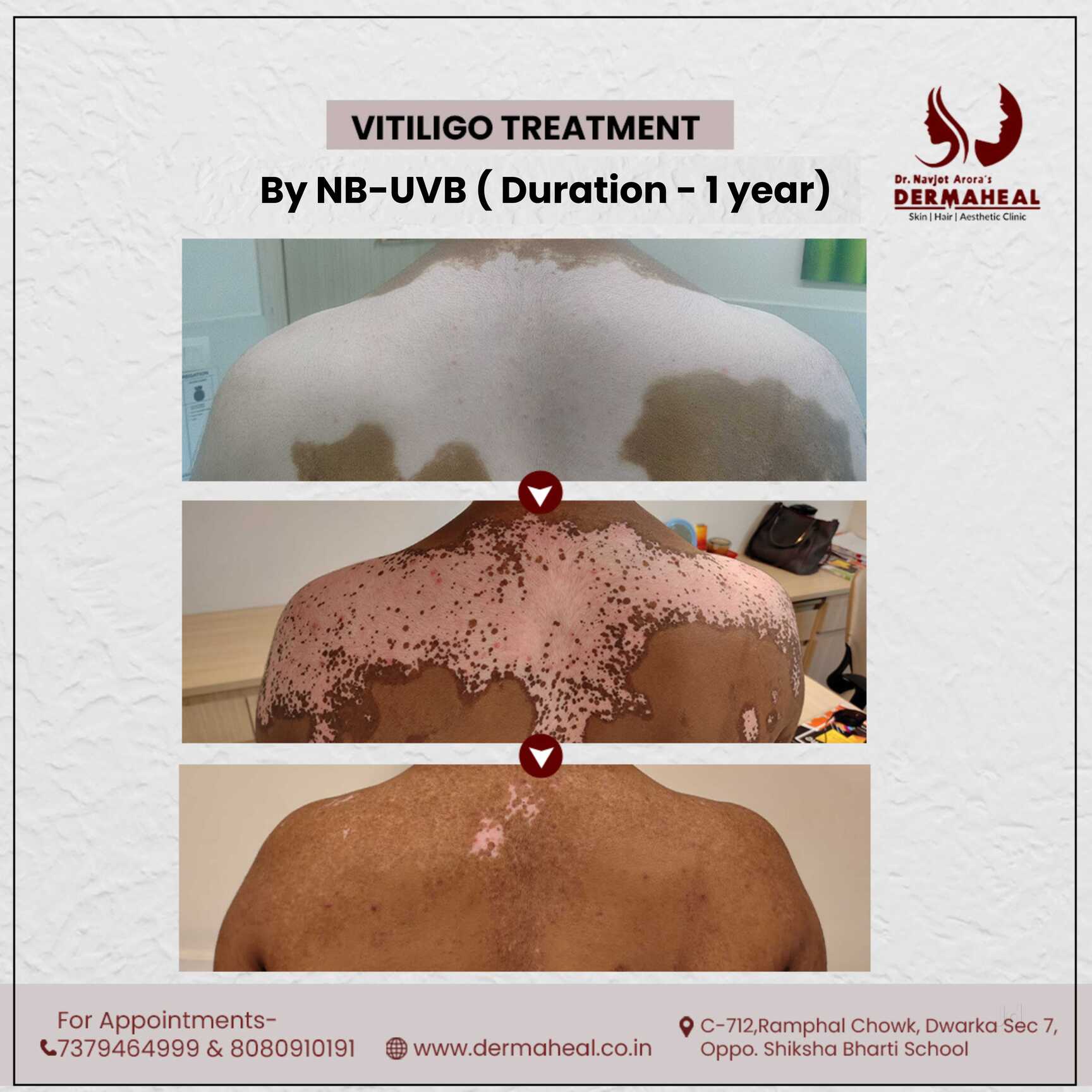 Top Dermatologists For Skin Biopsy in Dwarka, Delhi Best Skin