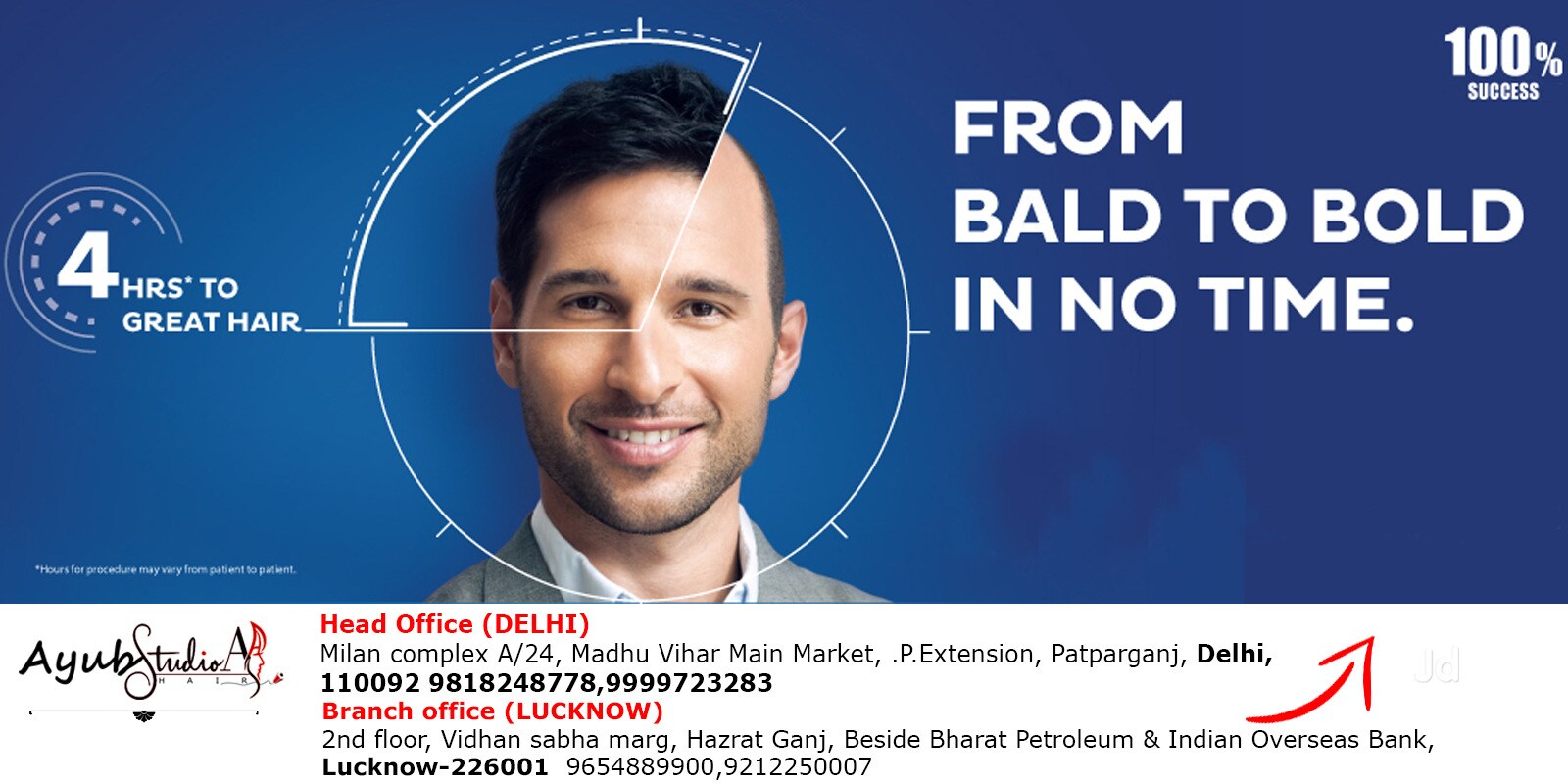 Top Hair Bonding Services For Men In Sahibabad Industrial Area