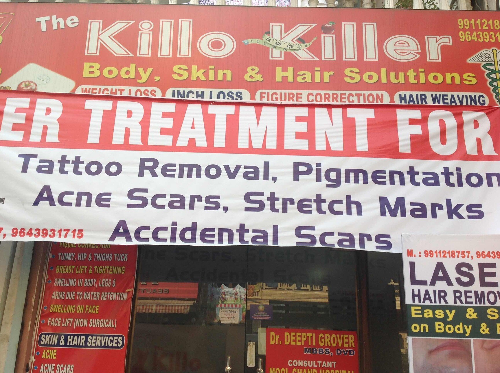 Kilo Killer Janakpuri Laser Hair Removal Treatment In Delhi