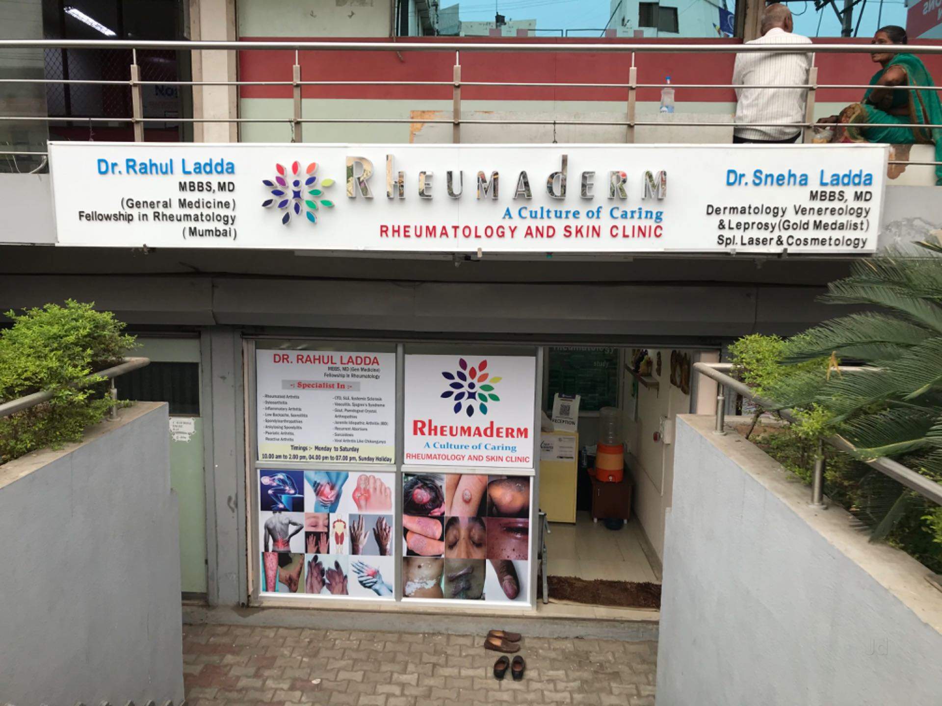 Top Stretch Mark Treatments For Ankylosing Spondylitis in Msk Mill