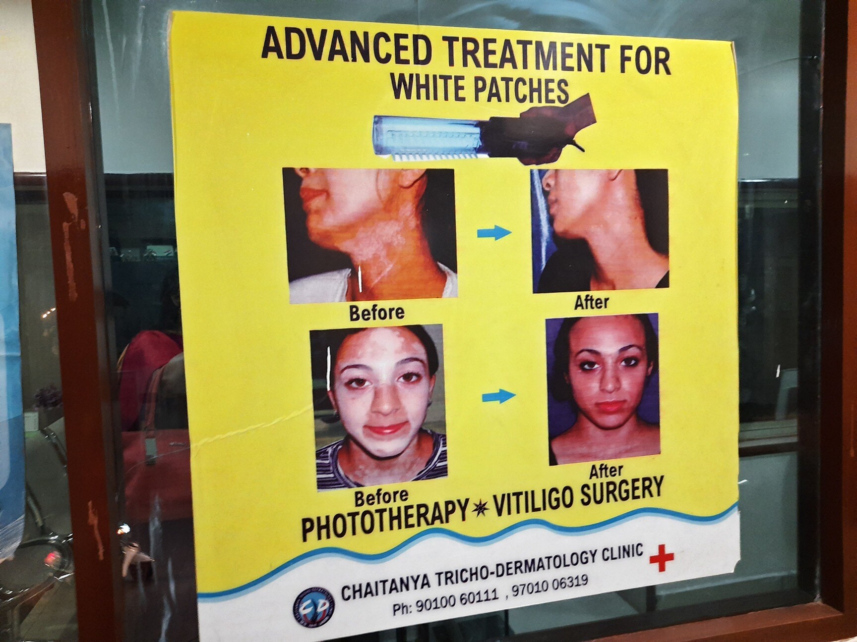Goutham Reddy Dermatologist Clinic Tarnaka Dermatologists In