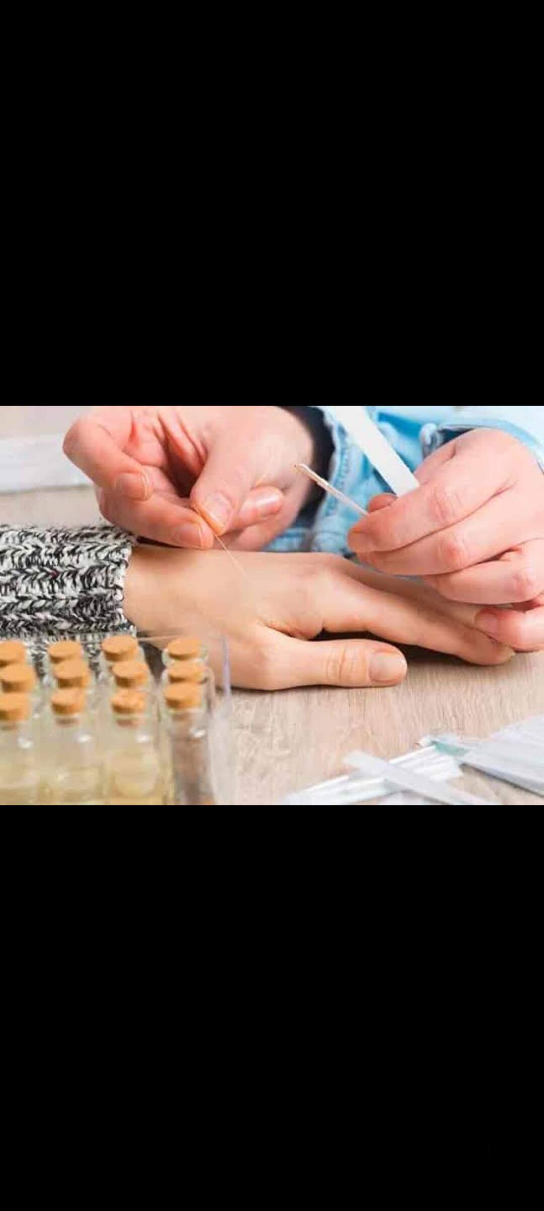 Top Acupuncture Treatment For Dry Eyes in Bangalore near me Justdial