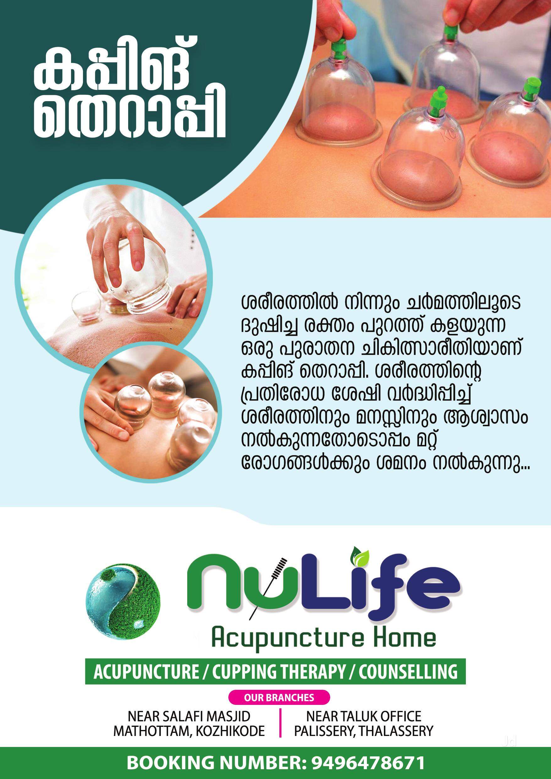 Top Acupuncture Treatment For Dry Eyes in Bangalore near me Justdial