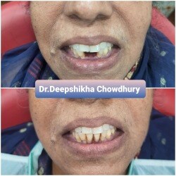 Dr. Deepshikha Chowdhury (Multispeciality Dental Clinic) in ...