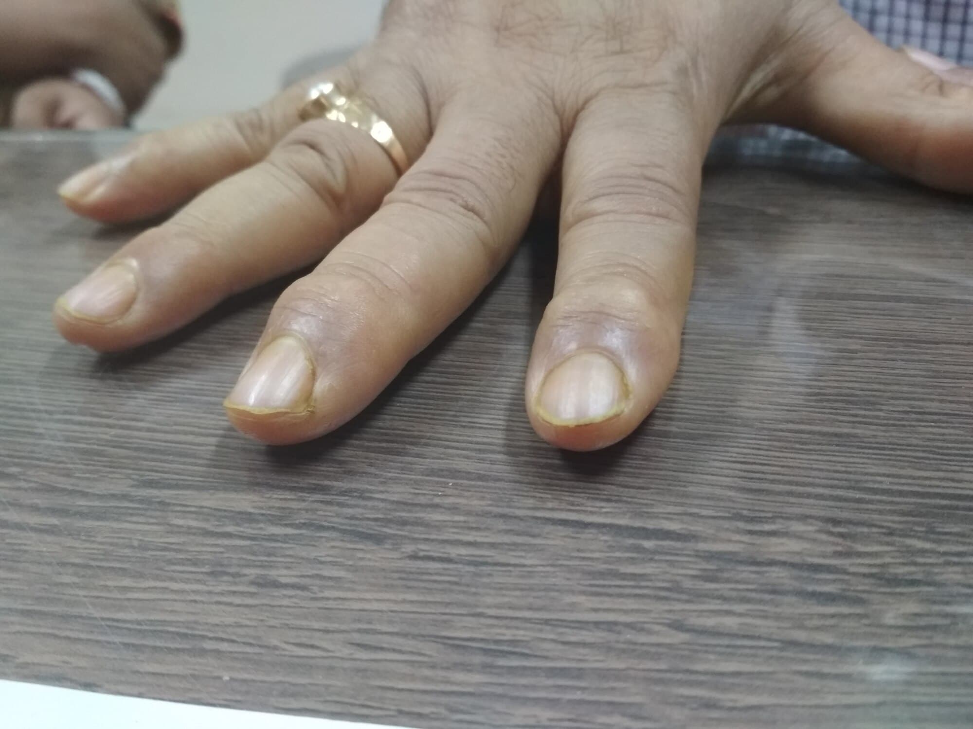 Top Rheumatology Hospitals in Tollygunge, Kolkata near me Justdial