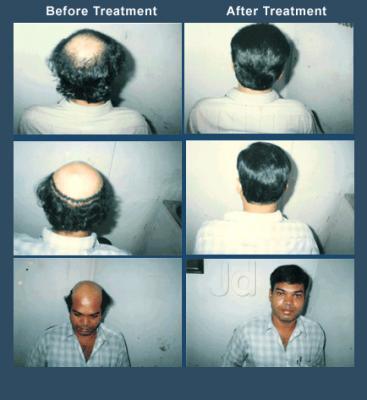 Pravin Hair Weaving Wigs Bandra East Beauty Parlours For Hair