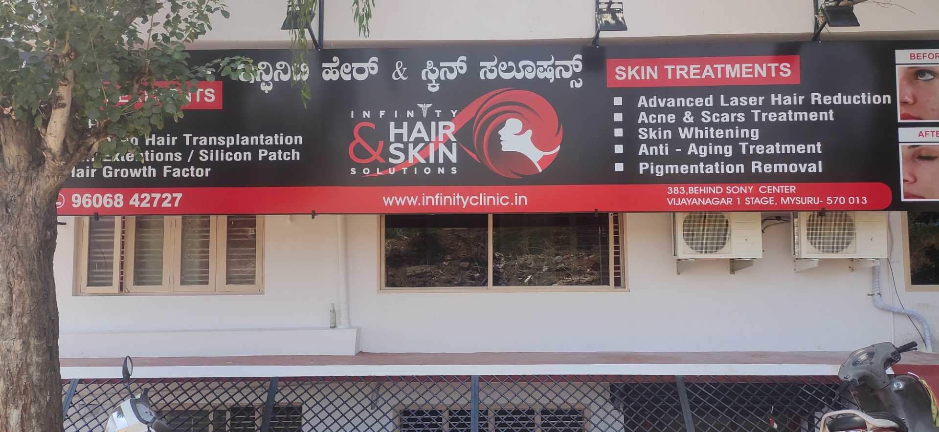 Top Pigmentation Removal Services in Hebbal, Mysore Justdial