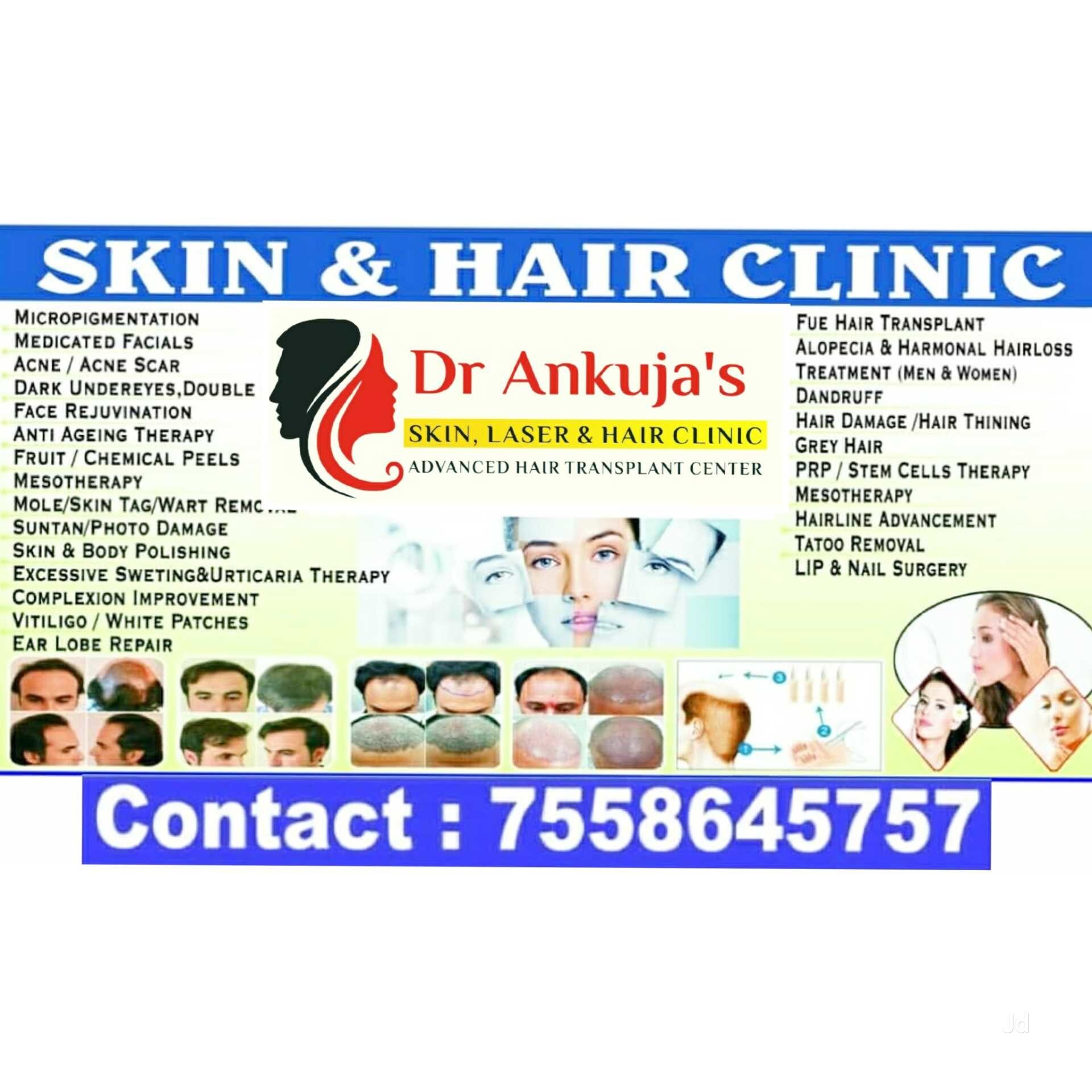 Top Anagen Hair Transplant Clinics in Pune near me Justdial