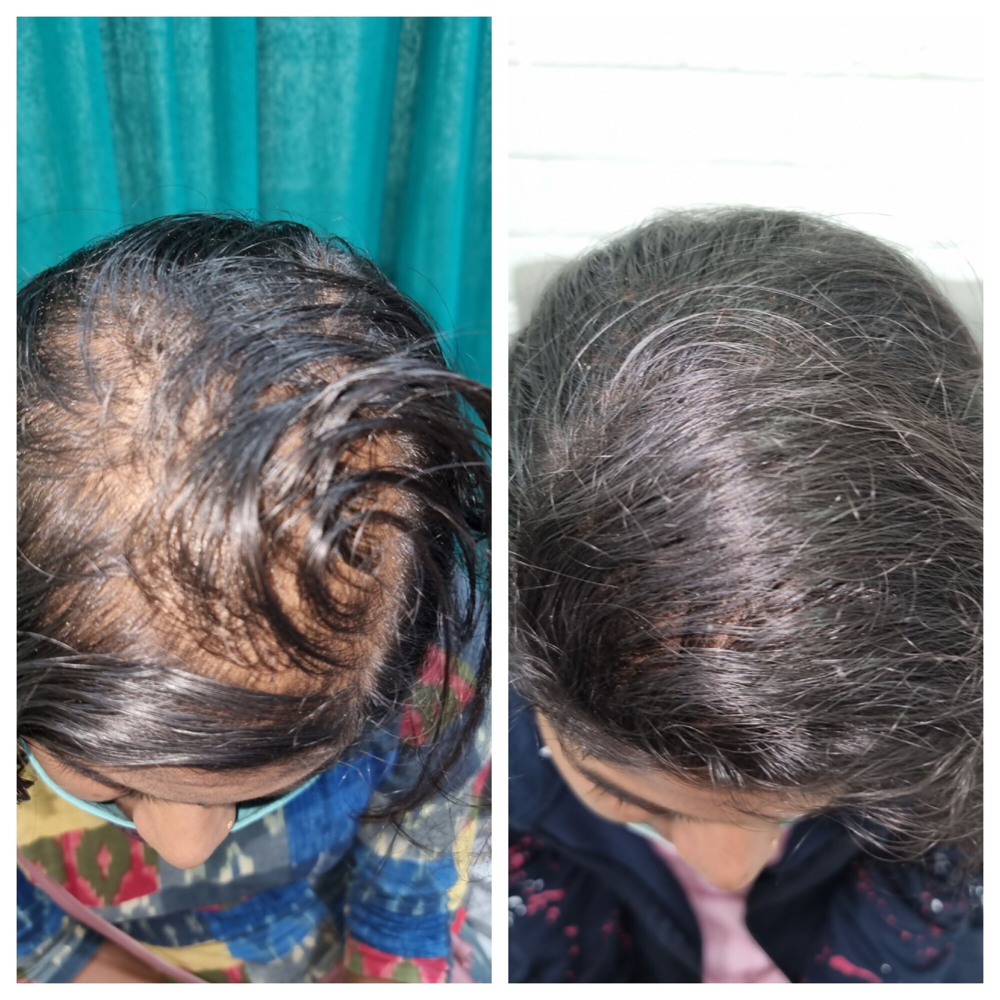 Top Dermatologists in RaipurChhattisgarh Best Skin Specialist near