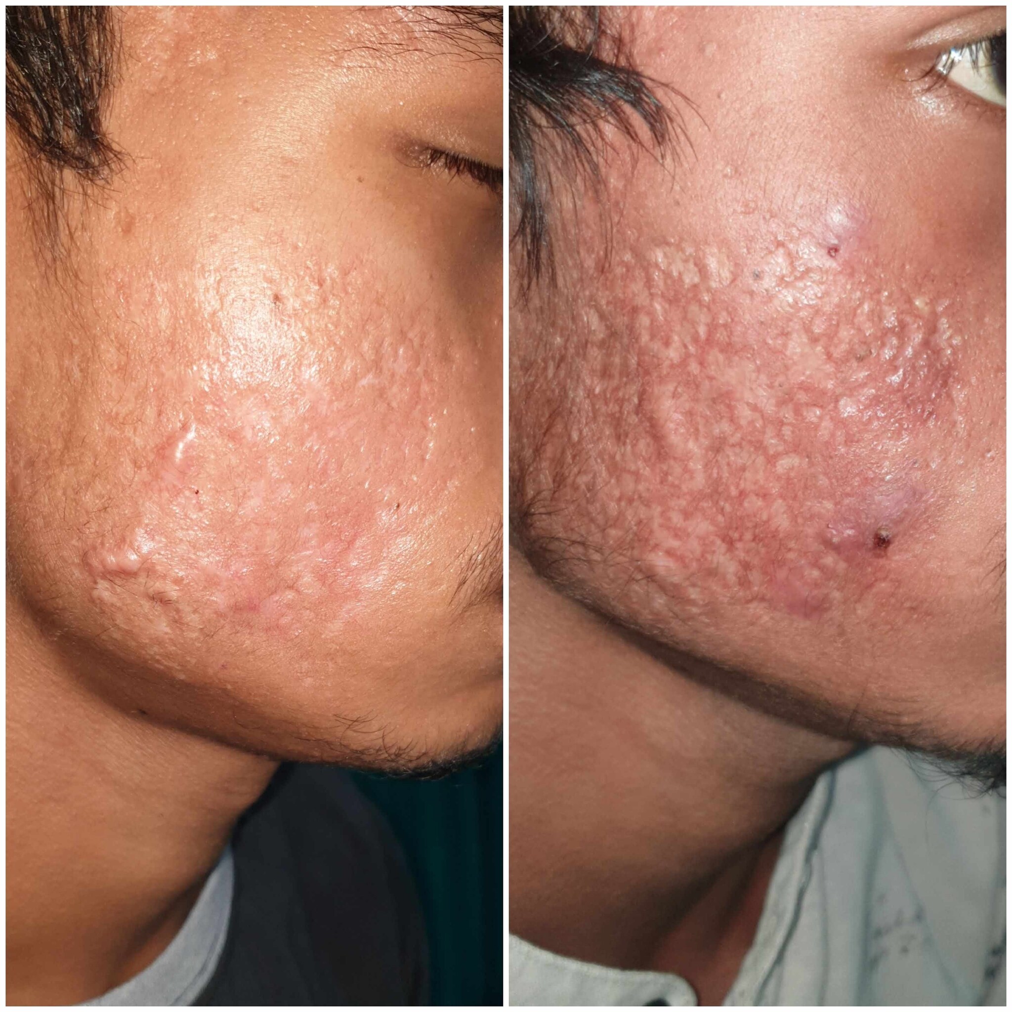 Top Dermatologists in RaipurChhattisgarh Best Skin Specialist near me Justdial