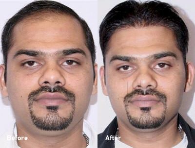 7 Unisex Salon Beauty Spas Book Appointment Online Beauty