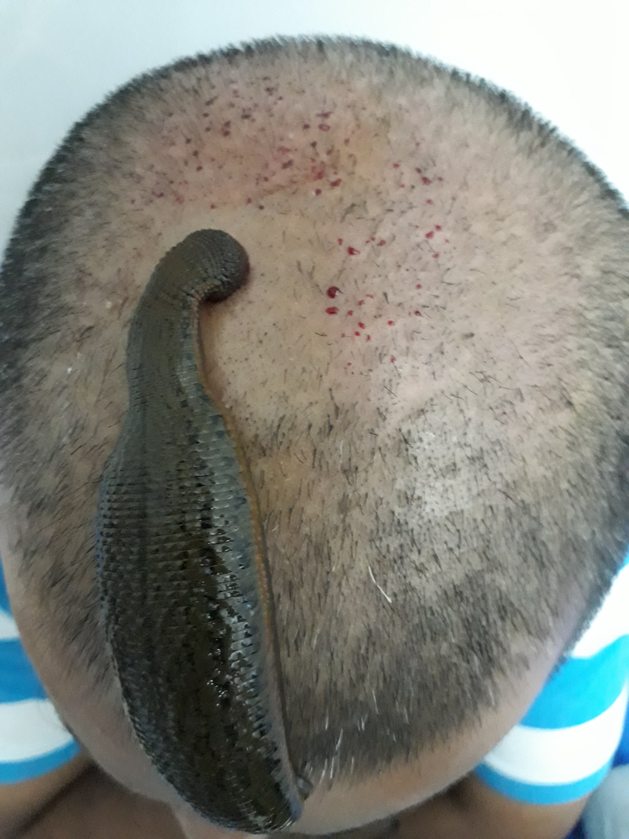 shyamosa skin clinic