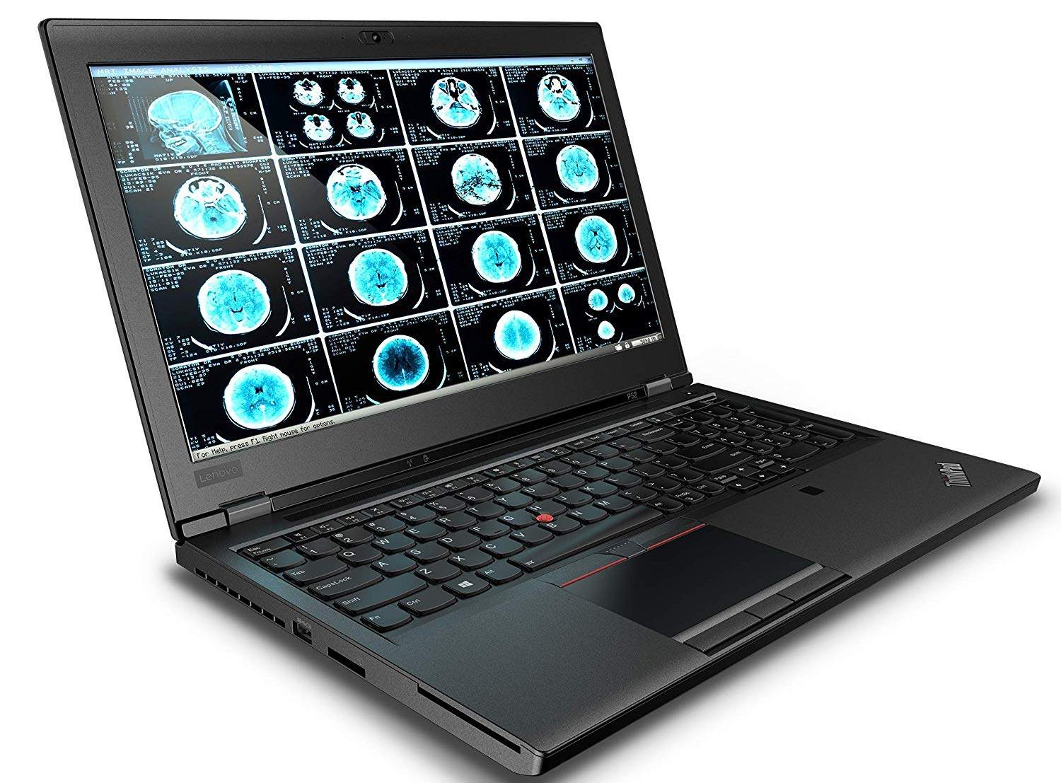 Lenovo Thinkpad P52 Intel Core i7 8th Gen Full HD Mobile
