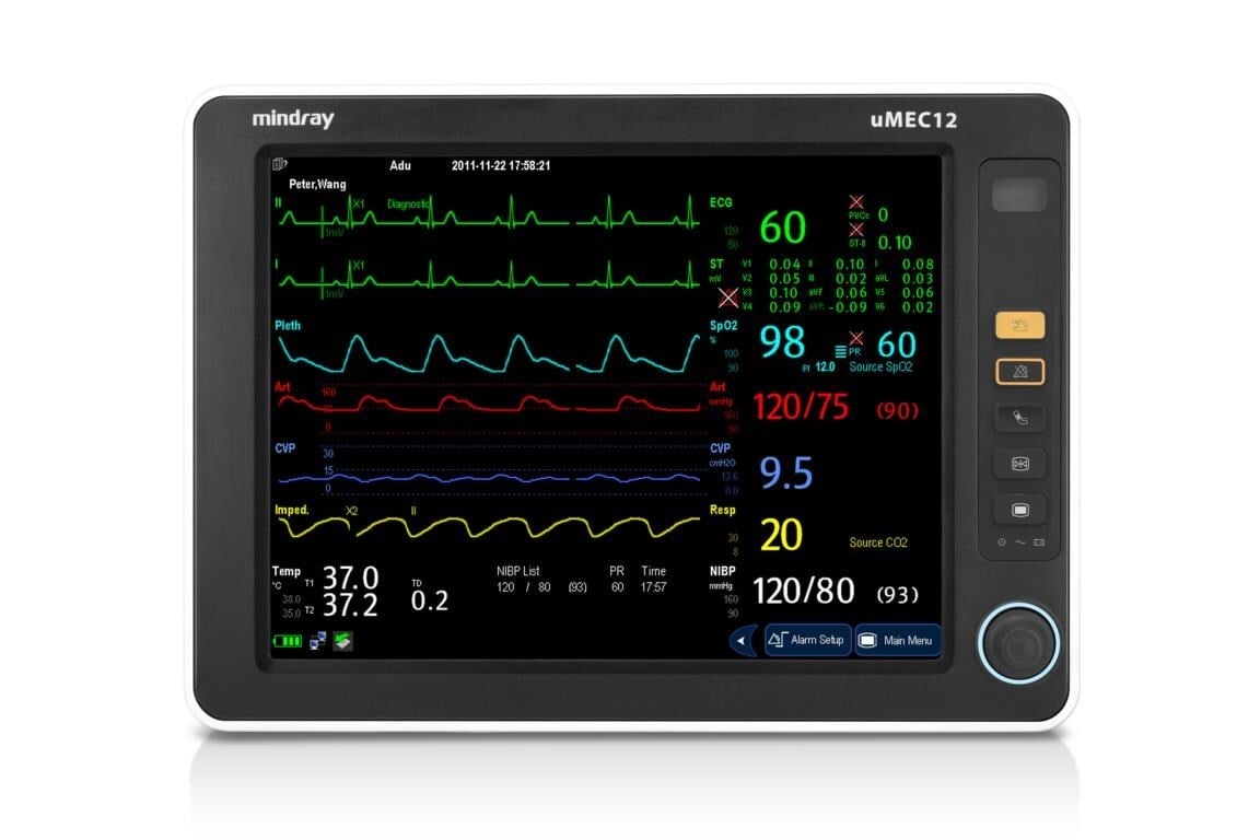 Patient Monitor