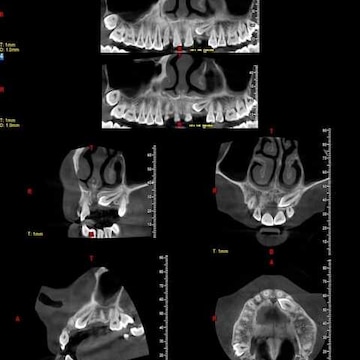 Dentscan in Azad Gunj,Baramulla - Best X Ray Centres near me in