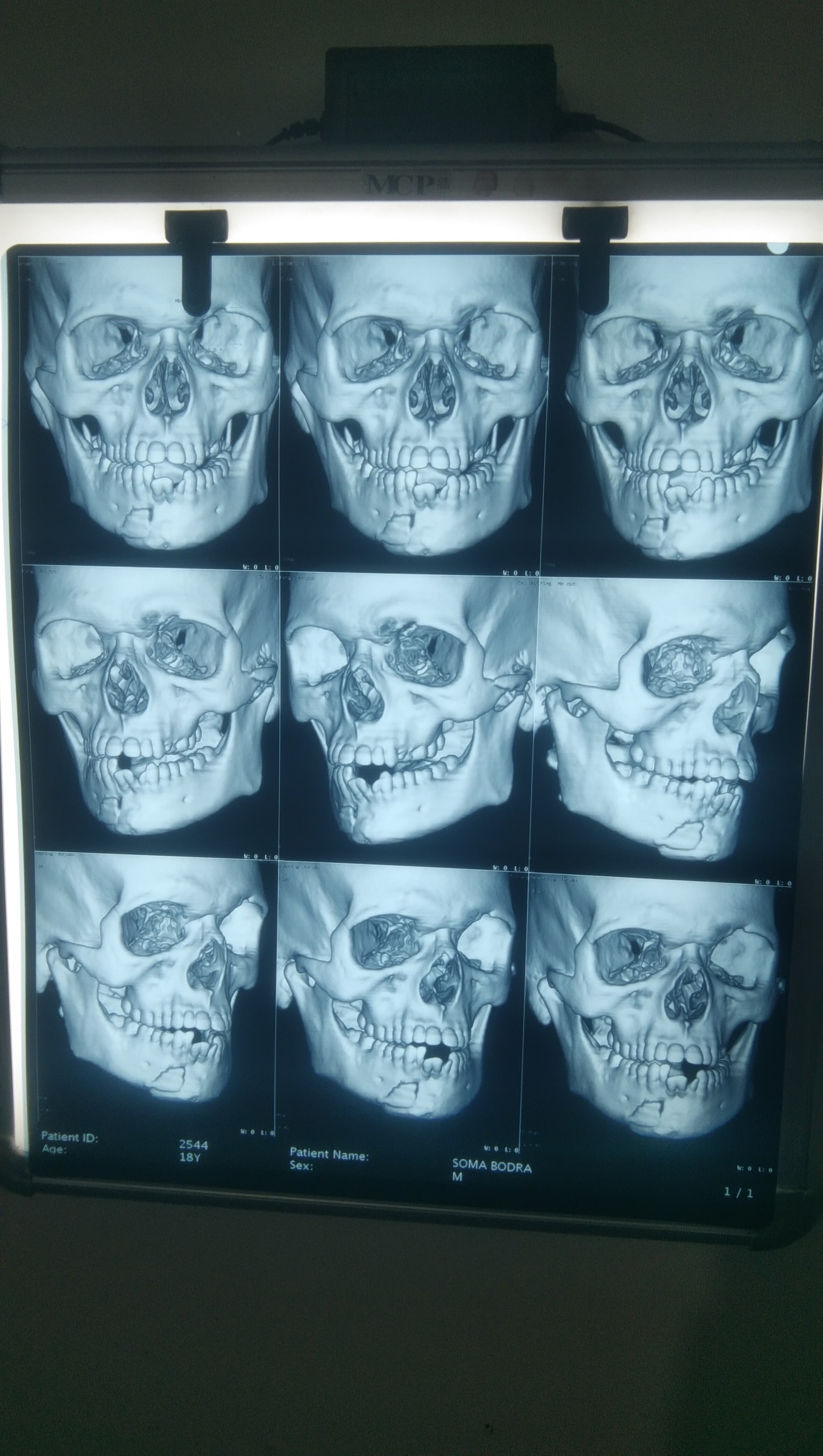 Lab view 7